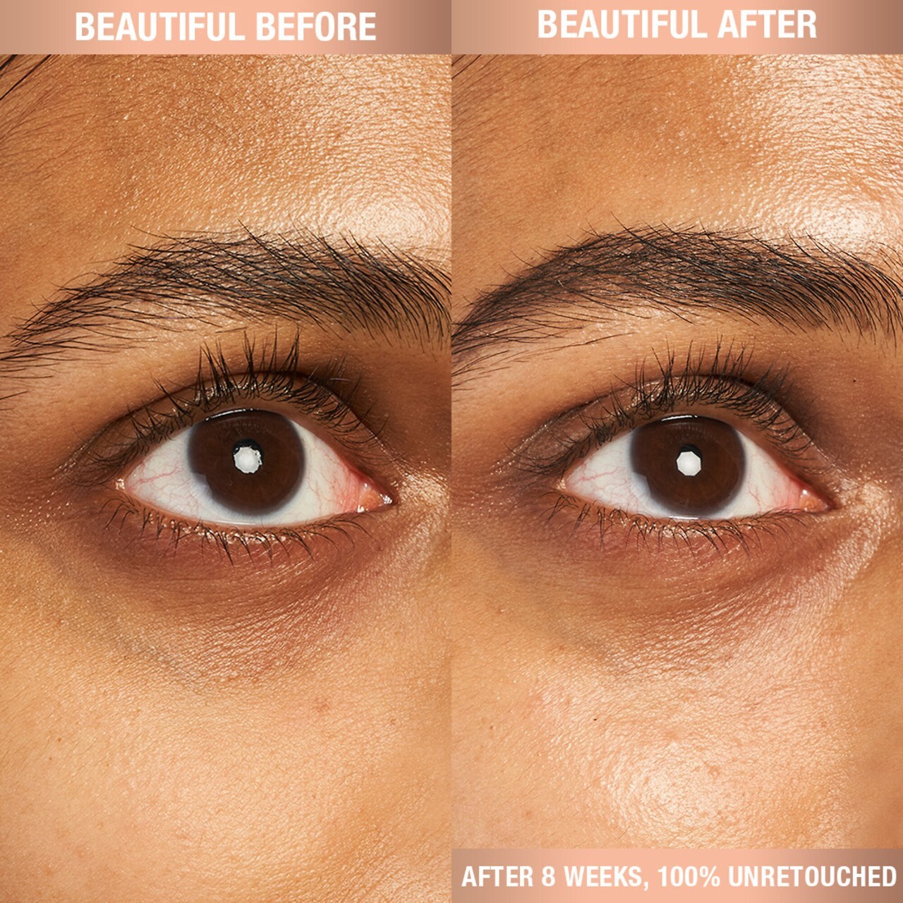 CHARLOTTE'S MAGIC EYE RESCUE